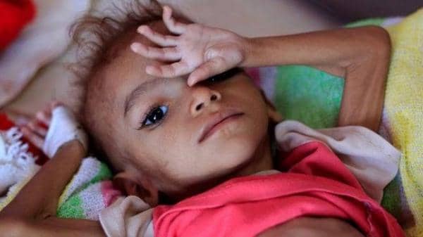 صحيفة أمريكية: أعمال الحوثيين الشنيعة سببت أسوأ أزمة إنسانية في العالم