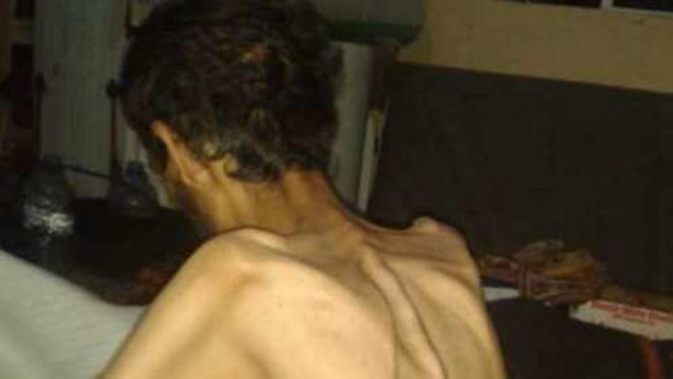 شاهد صورة مفزعة من سجون الحوثي