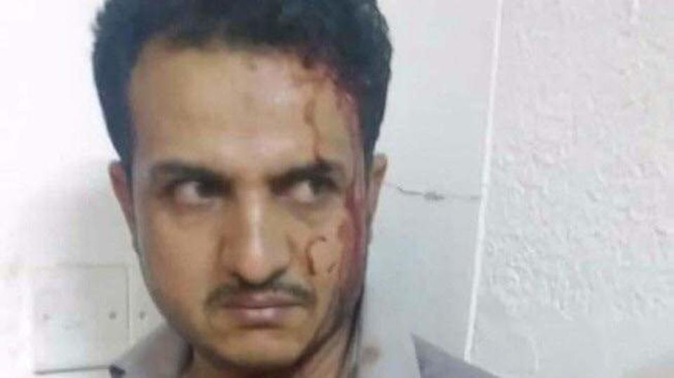 جريمة حوثية جديدة.. شاهد طبيب في صنعاء يتعرض للضرب والدماء تسيل من رأسه