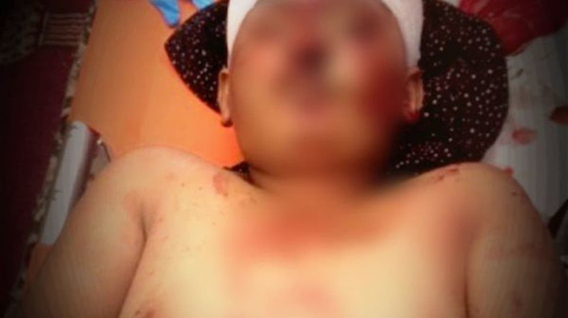 مقتل طفل برصاص قناص حوثي في البيضاء